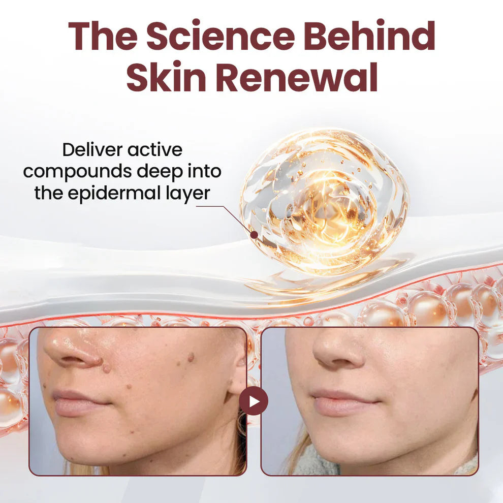 KeraErase® Dual-Action Renewal Cream( Buy 1 Get 1 Free)
