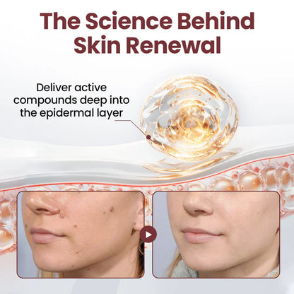 KeraErase® Dual-Action Renewal Cream( Buy 1 Get 1 Free)