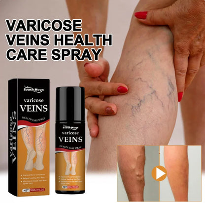 Varicose Vein Relief Spray (BUY 1 GET 1 FREE)