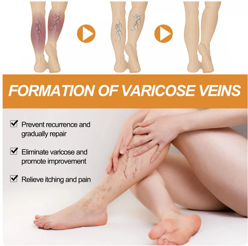 Varicose Vein Relief Spray (BUY 1 GET 1 FREE)