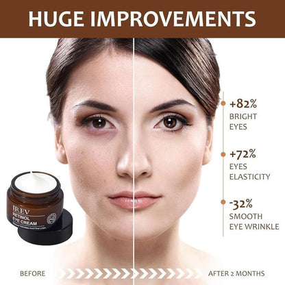 Retinol Eye Cream (️‍🔥Buy 1 Get 1 Free️‍🔥)